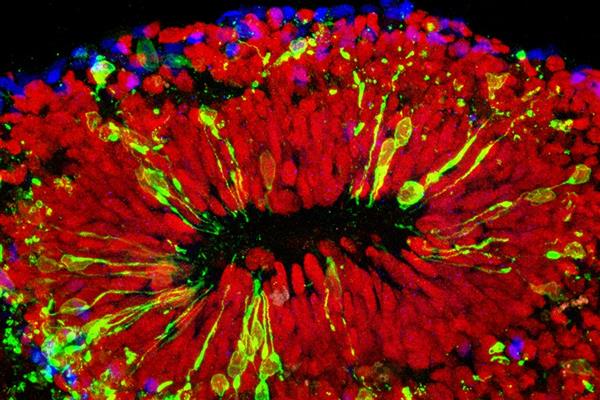 科學家攻克Zika病毒 高中生攜3D打印來幫忙
Zika病毒,3D打印醫療行業,3D打印材料價格,3D打印技術,3D打印材料,3D打印成本,3D打印價格