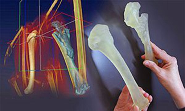 左邊是雄鷹健康的肱骨,右邊是雄鷹實際受傷的骨頭的復制品