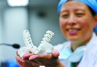 世界首例醫(yī)療3D打印應(yīng)用案例 3D打印假體骶椎成功植入