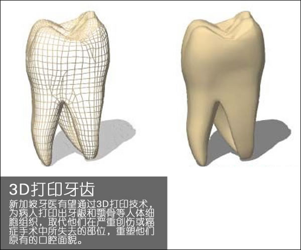 個性化醫療3D打印實戰案例與研究成果的問答整理_3d打印服務公司 個性化醫療3D打印實戰案例與研究成果的問答整理_3d打印服務公司