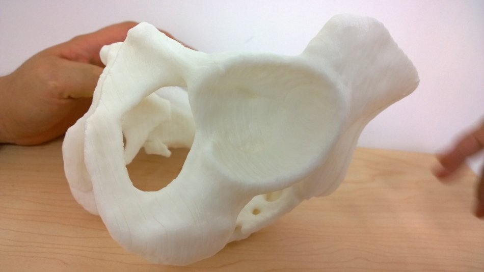 3d打印應(yīng)用領(lǐng)域之醫(yī)療應(yīng)用_e鍵打印服務(wù)公司 3d打印應(yīng)用領(lǐng)域之醫(yī)療應(yīng)用_e鍵打印服務(wù)公司